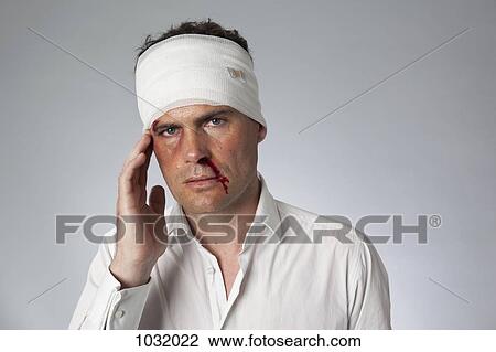 A man with bruises, a bloody nose and a bandaged head View Large Photo Image Stock Image - A man with bruises, a bloody nose and a bandaged head. Fotosearch