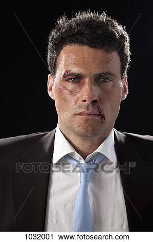 A tough businessman with bruises View Large Photo Image Stock Image - A tough businessman with bruises. Fotosearch