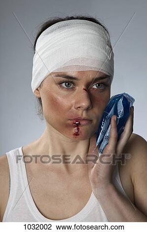 Stock Image - A woman with bruises and a bandaged head. Fotosearch