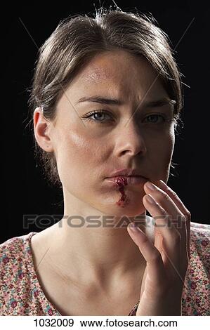 A woman with bruises and bloody lip View Large Photo Image Stock Photo - A woman with bruises and bloody lip. Fotosearch