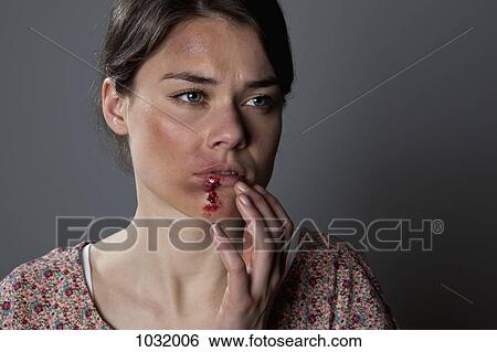 Stock Photograph - A woman with bruises and bloody lip. Fotosearch
