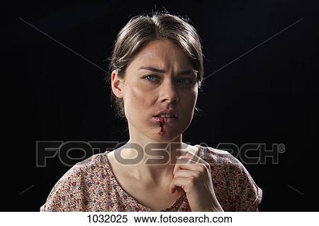 A woman with bruises and bloody lip View Large Photo Image Stock Photography - A woman with bruises and bloody lip. Fotosearch