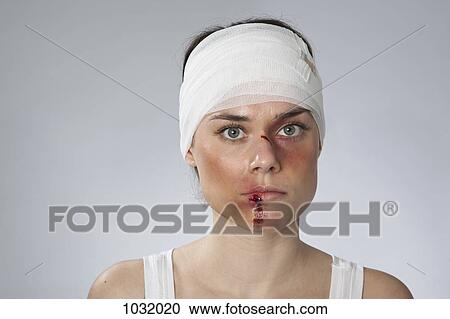 A woman with injuries and a bandaged head View Large Photo Image Stock Image - A woman with injuries and a bandaged head. Fotosearch