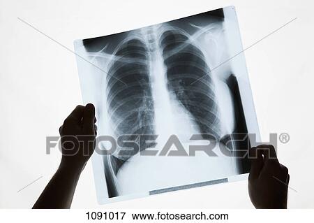 Hands holding a chest x-ray, close-up View Large Photo Image Stock Photo - Hands holding a chest x-ray, close-up. Fotosearch