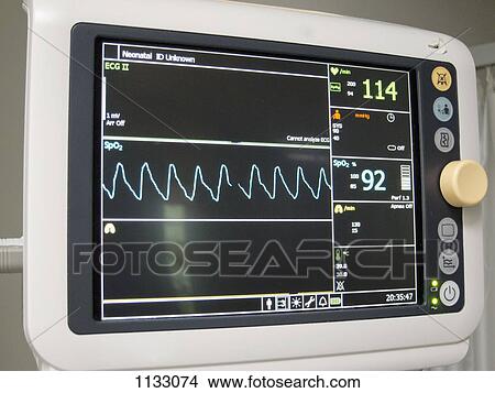Heart monitor View Large Photo Image Picture - Heart monitor. Fotosearch