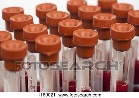 Blood samples in test tubes View Large Photo Image Stock Image - Blood samples in test tubes. Fotosearch