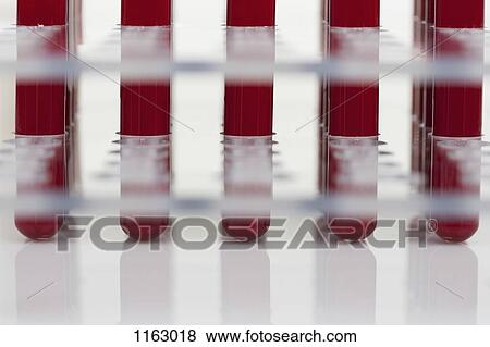 Row of blood samples in test tubes View Large Photo Image Stock Photo - Row of blood samples in test tubes. Fotosearch