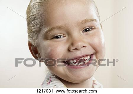 Stock Image - A happy young girl missing her two front teeth. Fotosearch