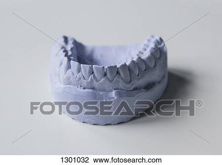Close-up of dental mould View Large Photo Image Stock Image - Close-up of dental mould. Fotosearch