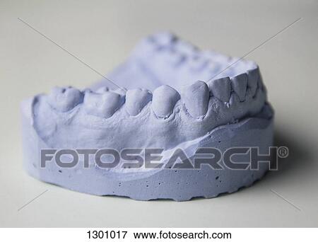 Close-up of dental mould View Large Photo Image Stock Photo - Close-up of dental mould. Fotosearch