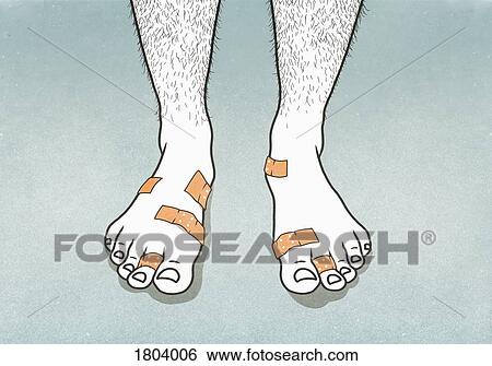 Bandages covering blisters on mans feet View Large Photo Image Stock Photograph - Bandages covering blisters on mans feet. Fotosearch