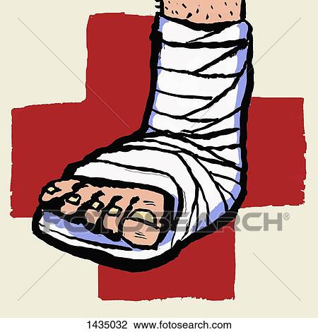 Illustration of leg with bandage and plus sign against white background View Large Illustration Drawing - Illustration of leg with bandage and plus sign against white background. Fotosearch