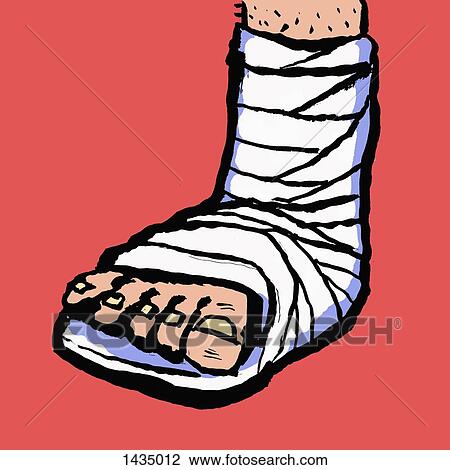 Drawing - Illustration of leg with bandage against red background. Fotosearch