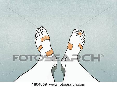 Stock Photo - Personal perspective man with bandages covering blisters on feet. Fotosearch