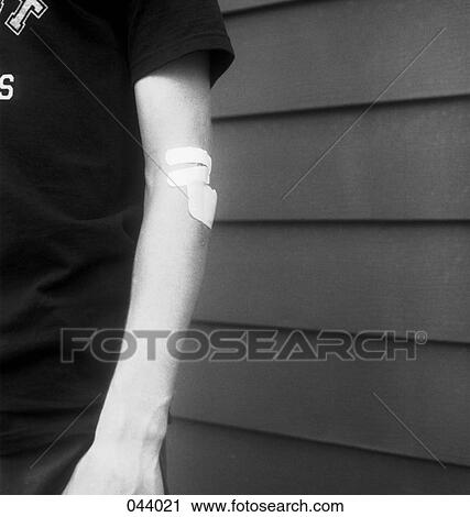 A person's arm with a bandage on it View Large Photo Image Stock Image - A person's arm with a bandage on it. Fotosearch