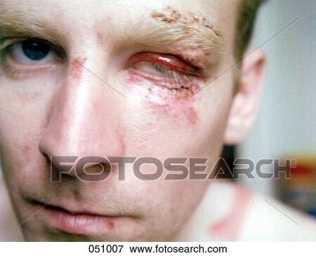 A man with a battered face View Large Photo Image Stock Photo - A man with a battered face. Fotosearch