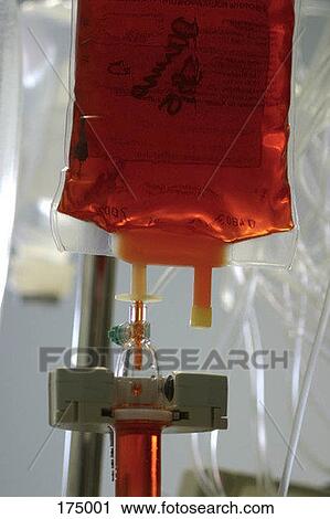 An intravenous drip filled with red fluid View Large Photo Image Stock Image - An intravenous drip filled with red fluid. Fotosearch