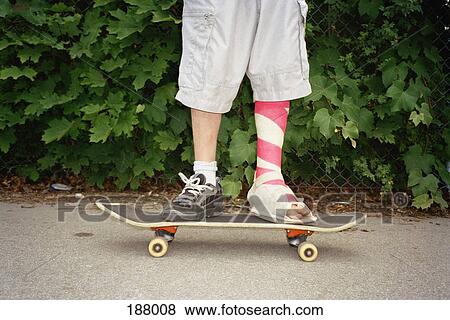 Young man with leg in plaster standing on skateboard View Large Photo Image Stock Photo - Young man with leg in plaster standing on skateboard. Fotosearch