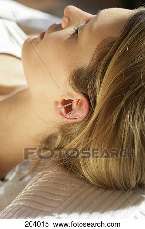 Close-up of woman with acupuncture needles on ear View Large Photo Image Stock Photography - Close-up of woman with acupuncture needles on ear. Fotosearch