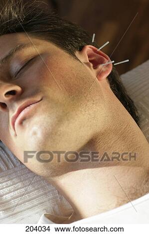 Man lying down with eyes closed and receiving acupuncture on ear View Large Photo Image Picture - Man lying down with eyes closed and receiving acupuncture on ear. Fotosearch