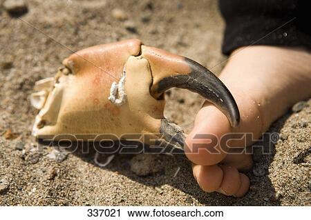 Crab claw pinching human foot View Large Photo Image Stock Image - Crab claw pinching human foot. Fotosearch