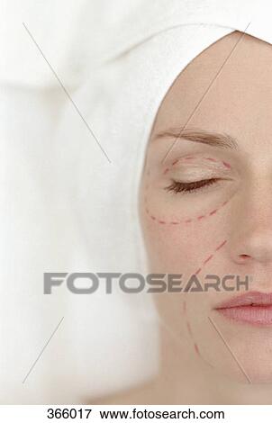 Woman with markings on face in preparation for plastic surgery View Large Photo Image Stock Photo - Woman with markings on face in preparation for plastic surgery. Fotosearch