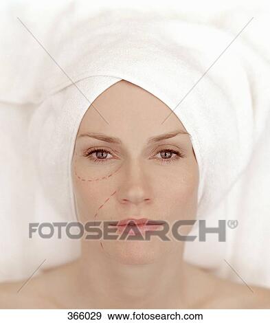 Stock Photo - Woman with markings on face in preparation for plastic surgery. Fotosearch