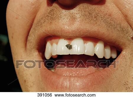 Man with food in his teeth View Large Photo Image Stock Photograph - Man with food in his teeth. Fotosearch