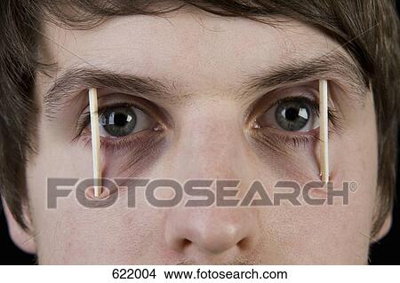 A man with matchsticks between his eyes View Large Photo Image Picture - A man with matchsticks between his eyes. Fotosearch