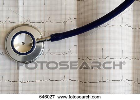 Close up of an electrocardiograph and a stethoscope View Large Photo Image Stock Photo - Close up of an electrocardiograph and a stethoscope. Fotosearch