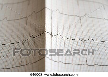 Close up of an electrocardiograph View Large Photo Image Stock Image - Close up of an electrocardiograph. Fotosearch