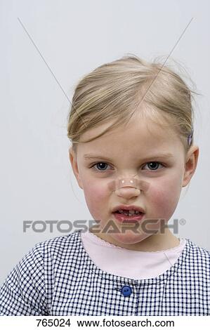 A young girl with a adhesive bandage on her nose View Large Photo Image Picture - A young girl with a adhesive bandage on her nose. Fotosearch