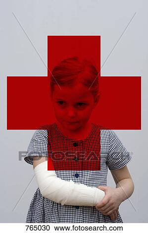 A young girl with a broken arm View Large Photo Image Stock Image - A young girl with a broken arm. Fotosearch