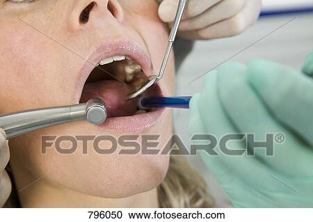 Stock Image - Close-up of a dentist inspecting a woman's mouth. Fotosearch