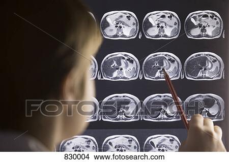 Picture - A doctor studying a MRI scan. Fotosearch