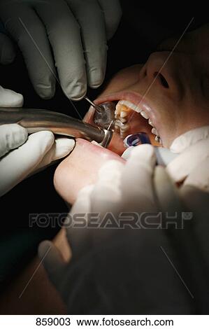 Stock Image - Close-up of a dentist and a dental assistant working on a female patient. Fotosearch