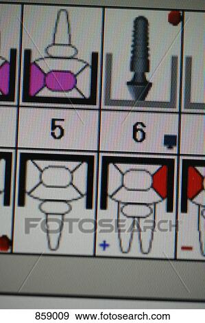 Detail of a computer screen showing a dental procedure View Large Photo Image Stock Photo - Detail of a computer screen showing a dental procedure. Fotosearch