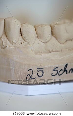Detail of a dental molding View Large Photo Image Stock Photograph - Detail of a dental molding. Fotosearch