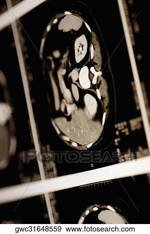 Close-up of an MRI Scan View Large Photo Image Stock Photo - Close-up of an MRI Scan. Fotosearch