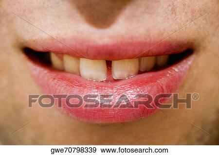 Stock Photo - Close-up of a human mouth. Fotosearch