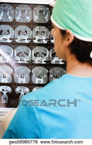 Rear view of a surgeon looking at an X-Ray View Large Photo Image Stock Photo - Rear view of a surgeon looking at an X-Ray. Fotosearch