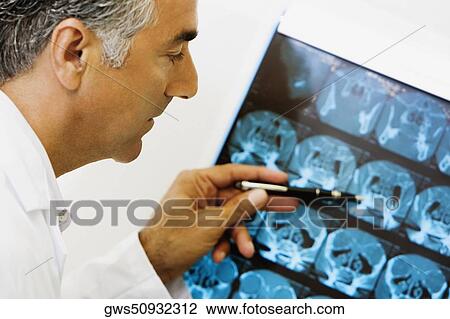 Stock Image - Side profile of a male doctor examining an X-Ray. Fotosearch