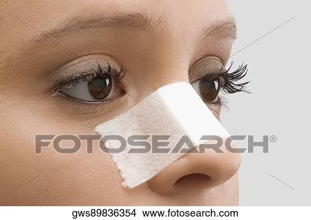 Picture - Close-up of a female patient with an adhesive bandage on her nose. Fotosearch