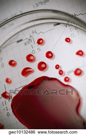 Close-up of a magnifying glass on blood cells View Large Photo Image Stock Photograph - Close-up of a magnifying glass on blood cells. Fotosearch