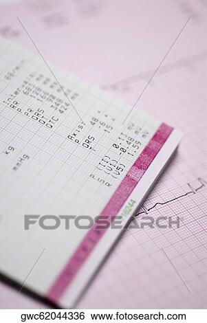 Close-up of a medical record View Large Photo Image Stock Photograph - Close-up of a medical record. Fotosearch