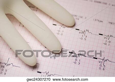 Close-up of a surgical glove on a medical report View Large Photo Image Stock Image - Close-up of a surgical glove on a medical report. Fotosearch