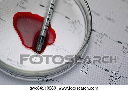 Close-up of a syringe and magnifying glass on a medical report View Large Photo Image Stock Photo - Close-up of a syringe and magnifying glass on a medical report. Fotosearch