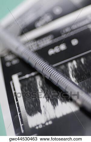 Close-up of a syringe on a medical report View Large Photo Image Stock Image - Close-up of a syringe on a medical report. Fotosearch