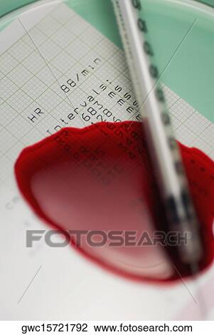 Close-up of a syringe with blood on an electrocardiogram report View Large Photo Image Stock Image - Close-up of a syringe with blood on an electrocardiogram report. Fotosearch