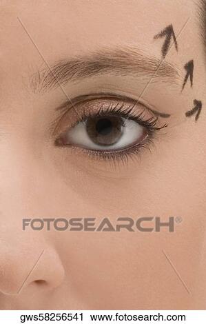 Stock Image - Close-up of a young woman with pre-surgical markings on her face. Fotosearch